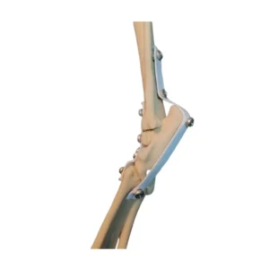 Tarsal Joint Left - Image 3