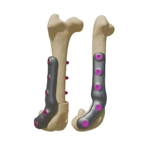 DFO - plate for correction of femoral deformities - Image 1
