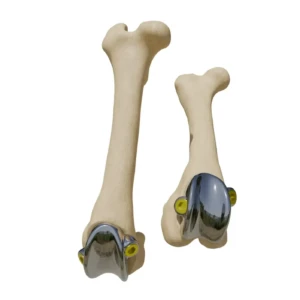 PGR - implant for reconstruction of the knee joint block of the femur - Image 1