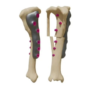TPO/TPLO - plate for correction of tibial deformities - Image 1
