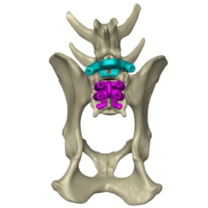 Bio3Dtech spinal stabilisation set - Image 5